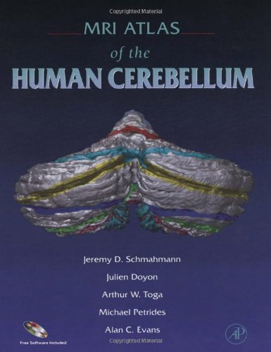 Imagen de archivo de MRI Atlas of the Human Cerebellum a la venta por Better World Books Ltd