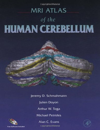 9780126256659: Mri Atlas of the Cerebellum