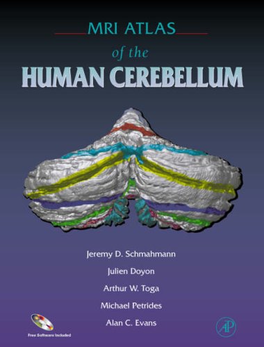 Stock image for MRI Atlas of the Human Cerebellum for sale by Better World Books Ltd