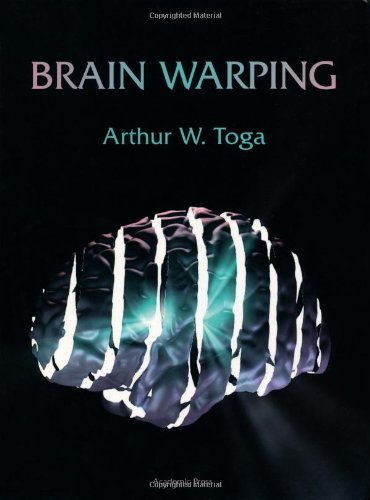 9780126925357: Brain Warping