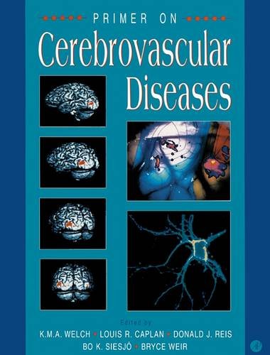 9780127431703: Primer on Cerebrovascular Diseases