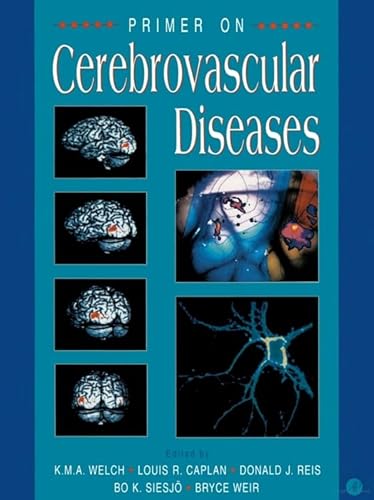 Imagen de archivo de Primer on Cerebrovascular Diseases a la venta por Better World Books