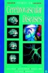 9780127431710: Primer on Cerebrovascular Diseases