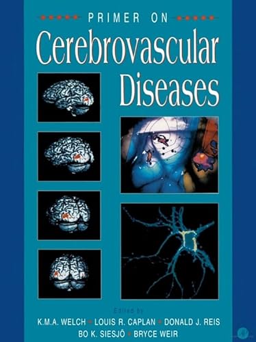 9780127431710: Primer on Cerebrovascular Diseases