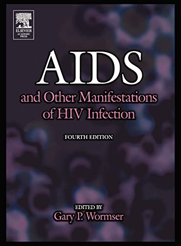 9780127640518: AIDS and Other Manifestations of HIV Infection