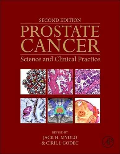 9780128000779: Prostate Cancer: Science and Clinical Practice