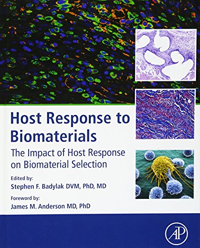 9780128001967: Host Response to Biomaterials: The Impact of Host Response on Biomaterial Selection