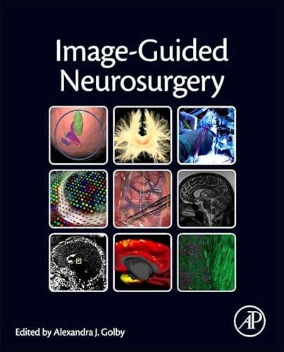 9780128008706: Image-Guided Neurosurgery