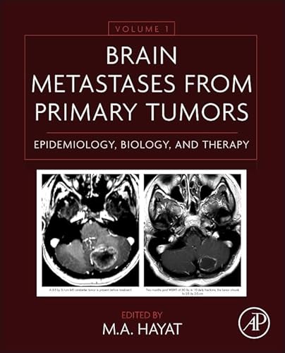 Imagen de archivo de Brain Metastases from Primary Tumors: Epidemiology, Biology, and Therapy: Vol 1 a la venta por Revaluation Books