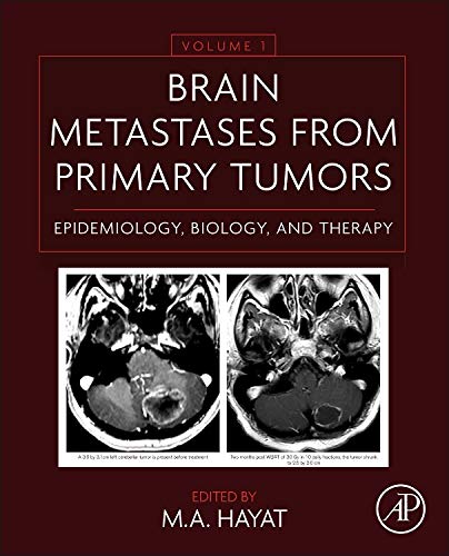 9780128008966: Brain Metastases from Primary Tumors: Epidemiology, Biology, and Therapy