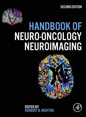 Stock image for Handbook of Neuro-Oncology Neuroimaging for sale by HPB-Red