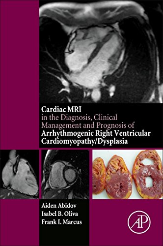 9780128012833: Cardiac MRI in the Diagnosis, Clinical Management and Prognosis of Arrhythmogenic Right Ventricular Cardiomyopathy/Dysplasia