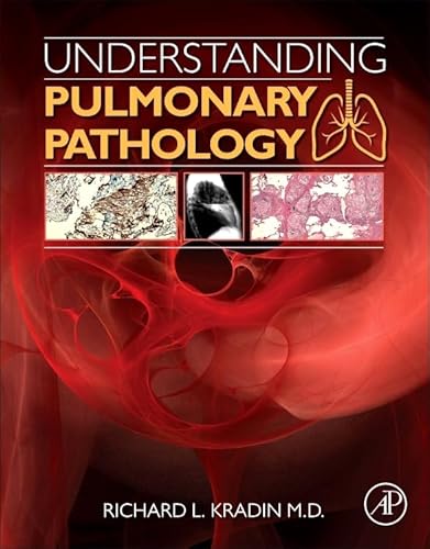 Stock image for Understanding Pulmonary Pathology: Applying Pathological Findings in Therapeutic Decision Making for sale by BGV Books LLC