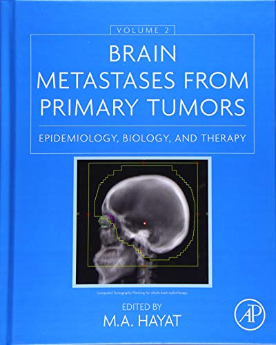 Imagen de archivo de Brain Metastases from Primary Tumors: Epidemiology, Biology, and Therapy: Vol 2 a la venta por Revaluation Books