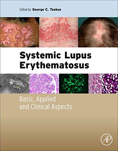 Stock image for Systemic Lupus Erythematosus : Basic, Applied and Clinical Aspects for sale by Better World Books