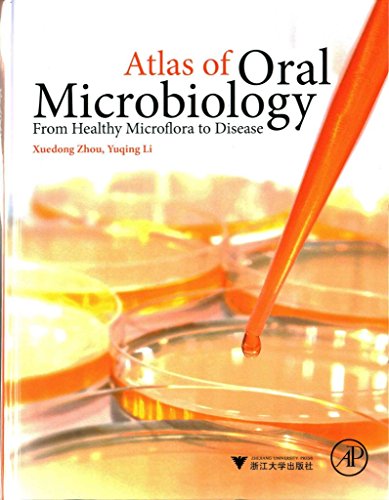 9780128022344: Atlas of Oral Microbiology: From Healthy Microflora to Disease