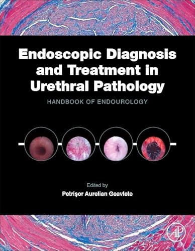 9780128024065: Endoscopic Diagnosis and Treatment in Urethral Pathology: Handbook of Endourology