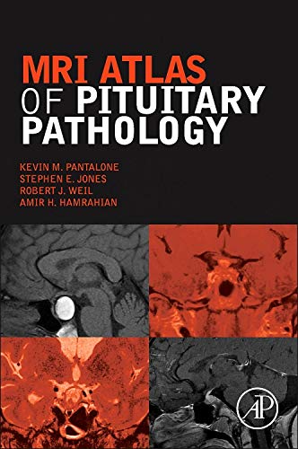 Beispielbild fr MRI Atlas of Pituitary Pathology zum Verkauf von Brook Bookstore On Demand