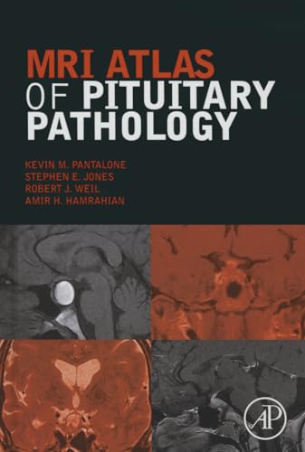 Stock image for MRI Atlas of Pituitary Pathology for sale by Chiron Media