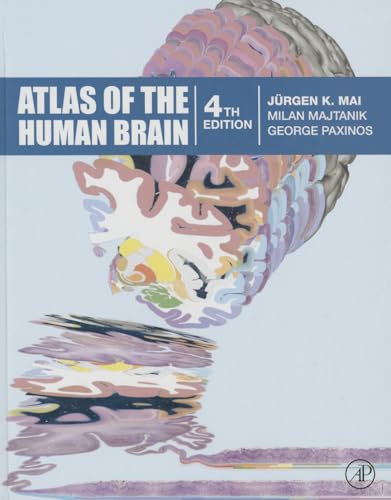 Stock image for Atlas of the Human Brain for sale by GF Books, Inc.