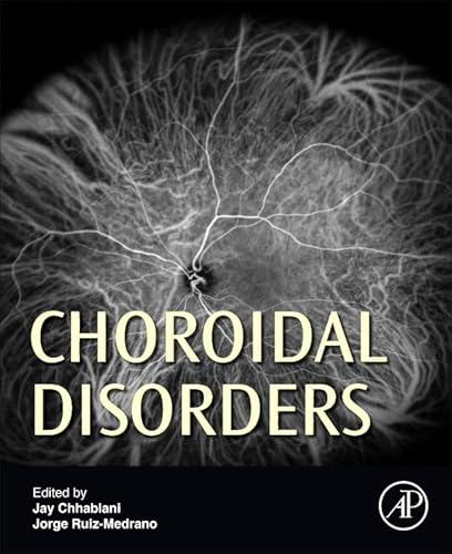 9780128053133: Choroidal Disorders