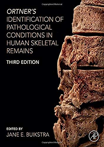 Stock image for Ortner's Identification of Pathological Conditions in Human Skeletal Remains for sale by Brook Bookstore