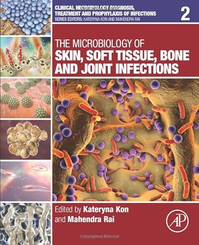 Stock image for The Microbiology of Skin, Soft Tissue, Bone and Joint Infections for sale by Revaluation Books