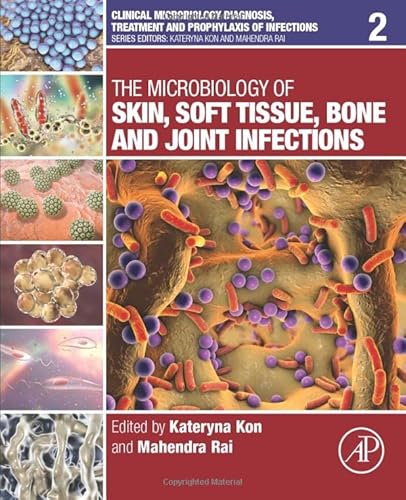 9780128110799: The Microbiology of Skin, Soft Tissue, Bone and Joint Infections: Volume 2 (Clinical Microbiology Diagnosis, treatment and prophylaxis of infections)