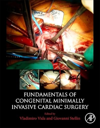 Stock image for Fundamentals of Congenital Minimally Invasive Cardiac Surgery for sale by GF Books, Inc.