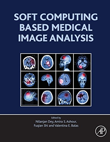 Stock image for Soft Computing Based Medical Image Analysis for sale by Brook Bookstore On Demand