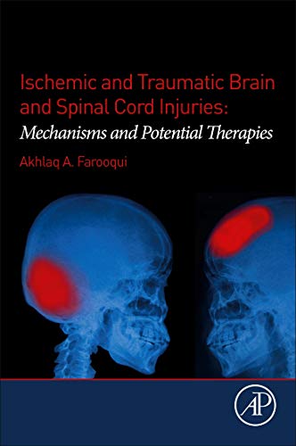 Imagen de archivo de Ischemic and Traumatic Brain and Spinal Cord Injuries: Mechanisms and Potential Therapies a la venta por Revaluation Books