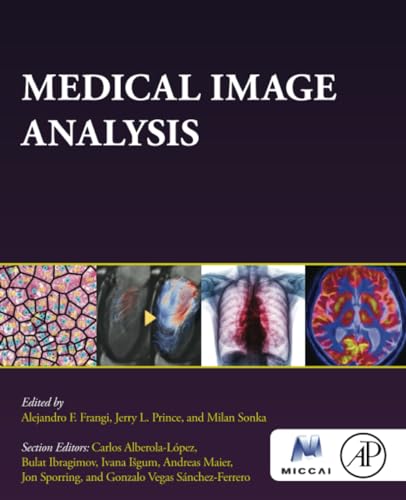 Stock image for Medical Image Analysis: 1ed for sale by Basi6 International