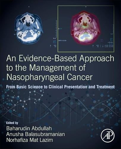 9780128144039: An Evidence-Based Approach to the Management of Nasopharyngeal Cancer: From Basic Science to Clinical Presentation and Treatment