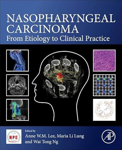 Imagen de archivo de Nasopharyngeal Carcinoma: From Etiology to Clinical Practice a la venta por Revaluation Books