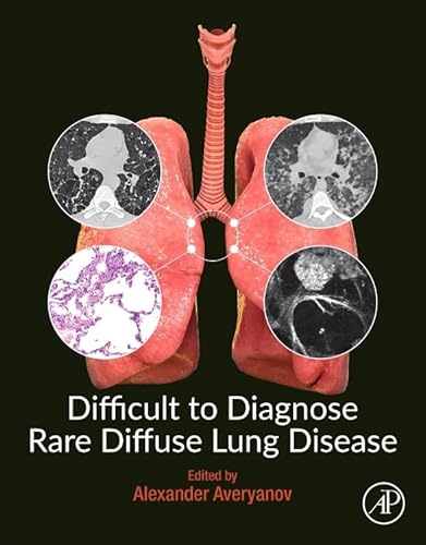 Stock image for Difficult to Diagnose Rare Diffuse Lung Disease for sale by GoldenWavesOfBooks