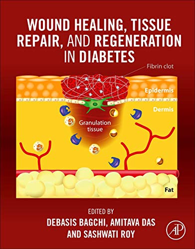 Stock image for Wound Healing, Tissue Repair, and Regeneration in Diabetes for sale by Brook Bookstore On Demand