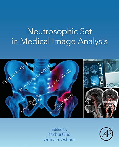 Stock image for Neutrosophic Set in Medical Image Analysis for sale by Brook Bookstore On Demand