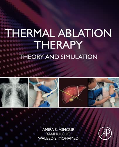 Stock image for Thermal Ablation Therapy: Theory and Simulation for sale by Brook Bookstore On Demand