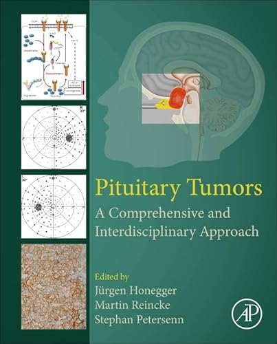 9780128199497: Pituitary Tumors: A Comprehensive and Interdisciplinary Approach