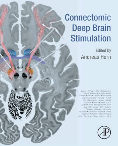 Beispielbild fr Connectomic Deep Brain Stimulation zum Verkauf von BooksRun