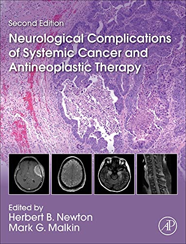 Stock image for Neurological Complications of Systemic Cancer and Antineoplastic Therapy for sale by Books Unplugged