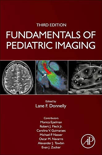 Stock image for Fundamentals of Pediatric Imaging for sale by GF Books, Inc.