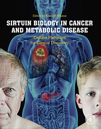 Stock image for SIRTUIN BIOL IN CANCER&METAB DISE for sale by Brook Bookstore On Demand