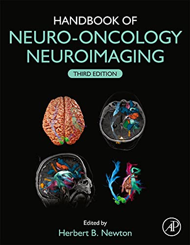 Beispielbild fr Handbook of Neuro-Oncology Neuroimaging zum Verkauf von BooksRun