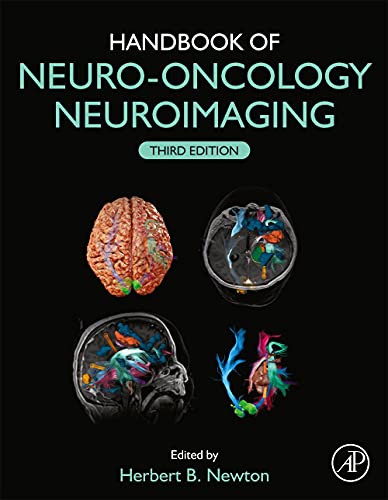 Stock image for Handbook of Neuro-Oncology Neuroimaging for sale by BooksRun
