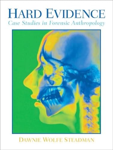 Beispielbild fr Hard Evidence: Case Studies in Forensic Anthropology zum Verkauf von WorldofBooks