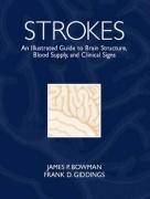 Imagen de archivo de Strokes: An Illustrated Guide to Brain Structure, Blood Supply and Clinical Signs a la venta por ThriftBooks-Atlanta