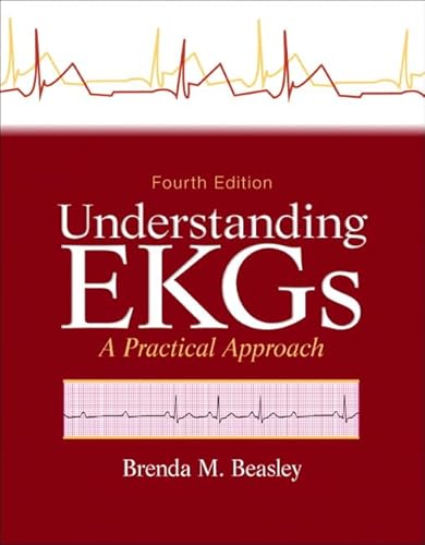 Understanding EKGs: A Practical Approach (9780133147728) by Beasley, Brenda