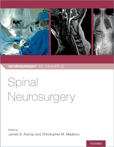 9780190887773: Spinal Neurosurgery (Neurosurgery by Example)