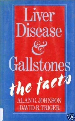 Imagen de archivo de Liver Disease and Gallstones: The Facts (The ^AFacts Series) a la venta por MusicMagpie